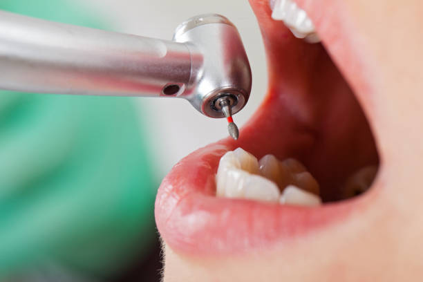Best After-Hours Emergency Dentist in Milford, IN